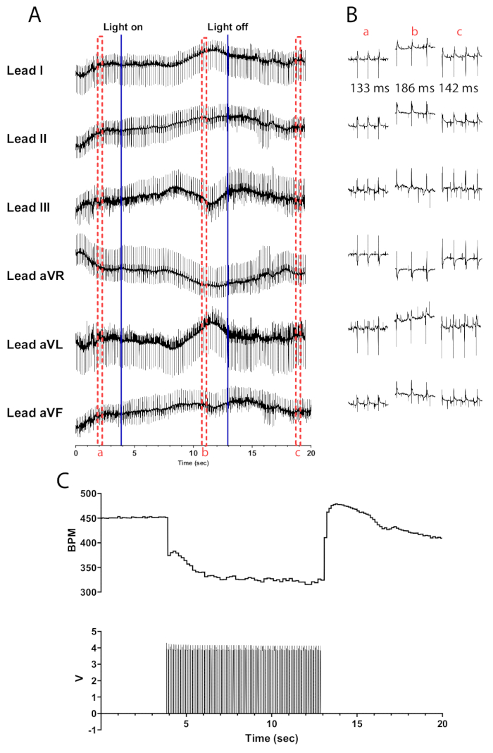 figure-results-2 ECG analysis with light stimulus; multiple leads, heart rate (BPM) chart; electrophysiology data.