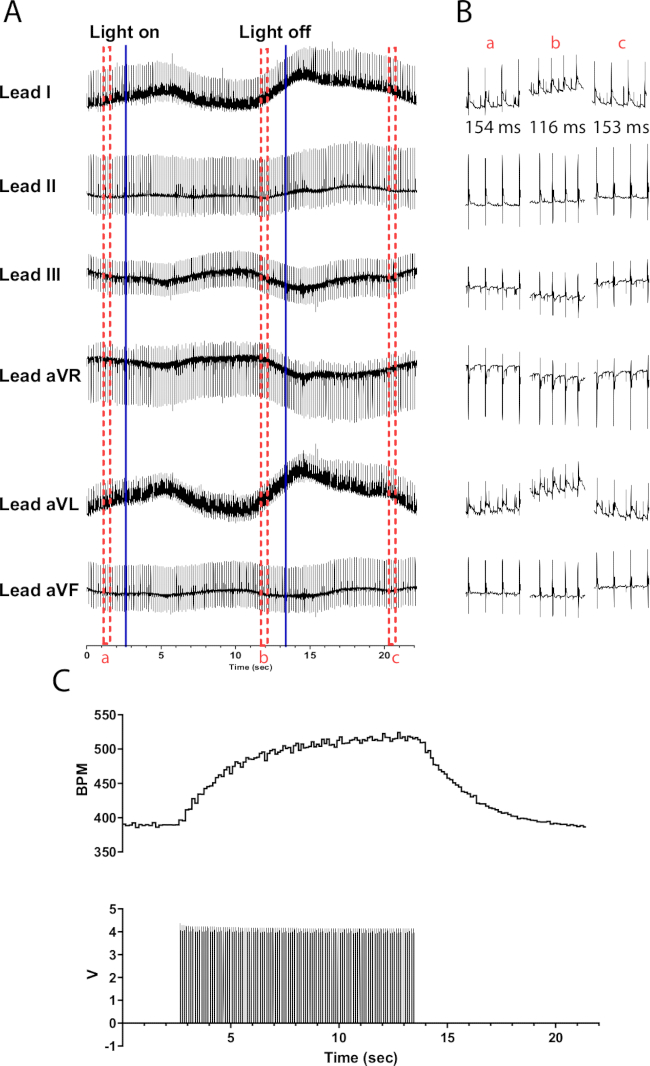 figure-results-3 ECG data analysis, light on/off effect, heart rate, electrophysiology graphs, BPM measurement.