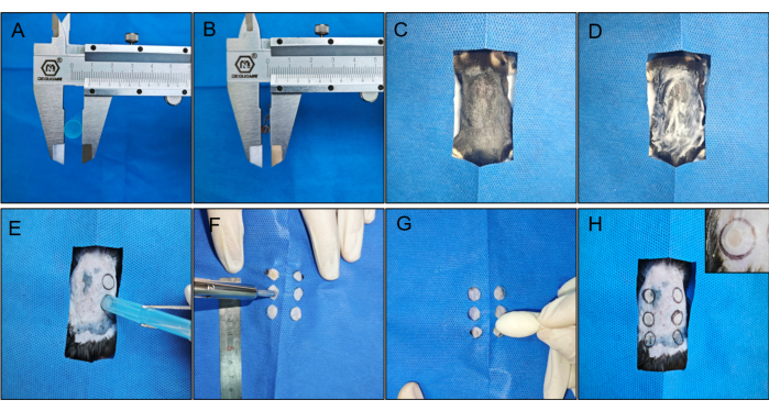 figure-results-3 Tissue measurement and extraction procedure using calipers on blue surgical drape; experimental setup.