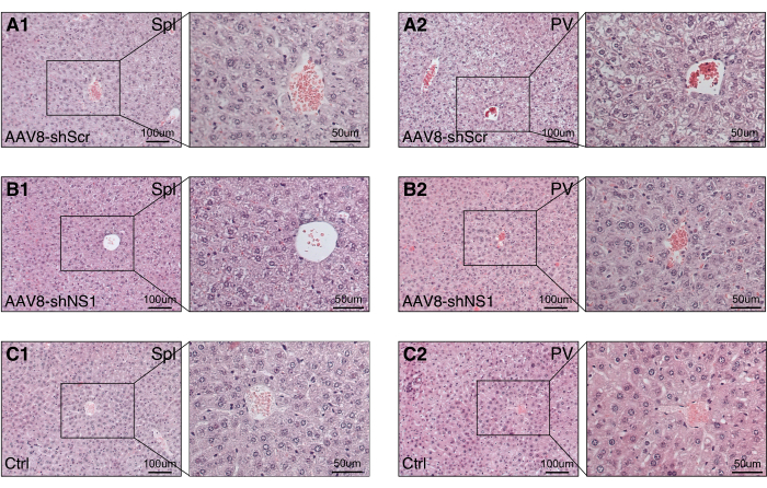 Histological comparison of liver sections; AAV8-shScr, AAV8-shNS1, and control; zoomed insets show cellular changes, stained microscopy results clarify tissue alterations in hepatic portal (PV) and splenic (Spl) regions.