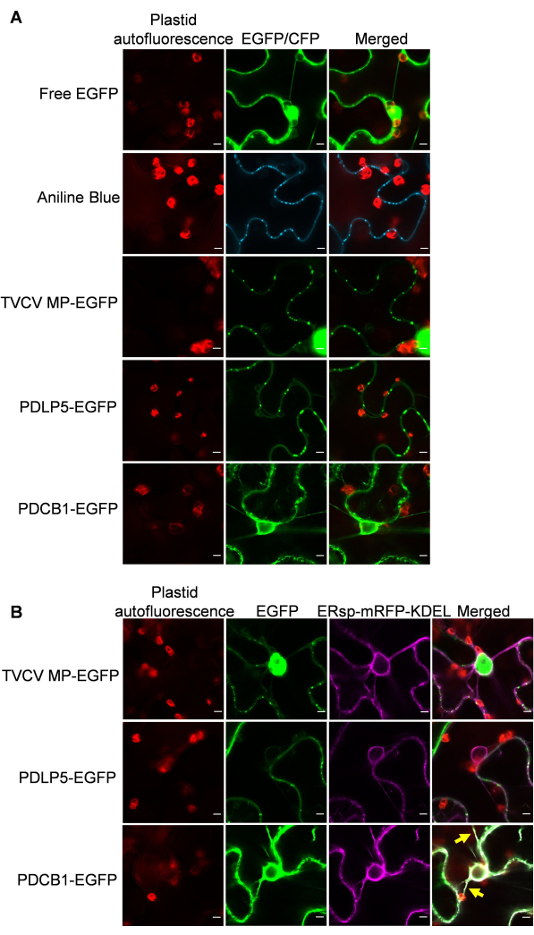 Fluorescence microscopy of plant cells; EGFP labeling; plastid autofluorescence, merged channels.