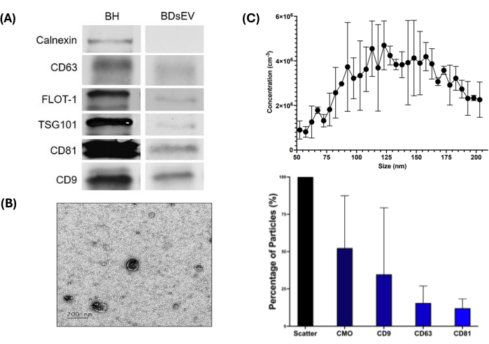 figure-results-3 Western blot protein analysis, nanoparticle micrograph, and particle size distribution chart.