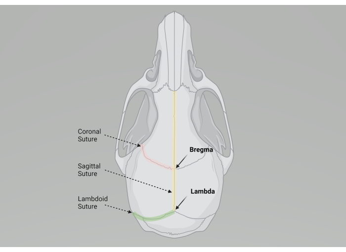 Skull anatomy diagram showing sutures: coronal, sagittal, lambdoid, with landmarks bregma, lambda.