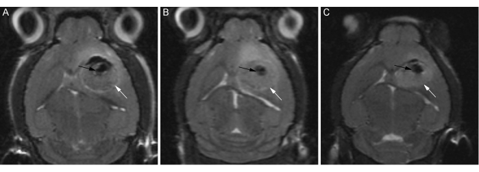 Brain MRI scan sequence; T2-weighted images; tumor detection analysis; medical imaging study.