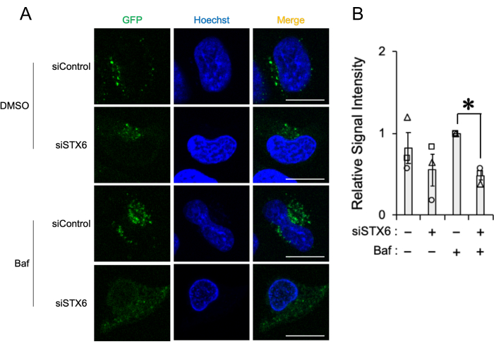 figure-results-3 Immunofluorescence microscopy GFP, Hoechst staining, siRNA treatment comparison, bar graph analysis.