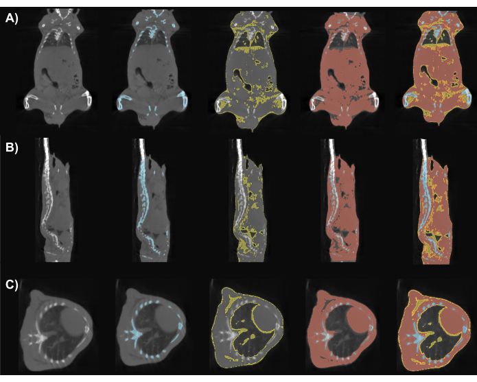 figure-results-2 Three-panel CT scan segmentation showing axial, sagittal, and coronal views of anatomical structures.