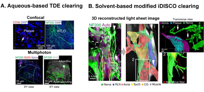 Aqueous-based TDE and iDISCO clearing; confocal and multiphoton microscopy revealing nerve fibers.