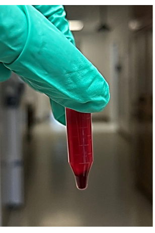 figure-results-2 Laboratory blood sample in red vial, biochemical analysis, medical research experiment setup.