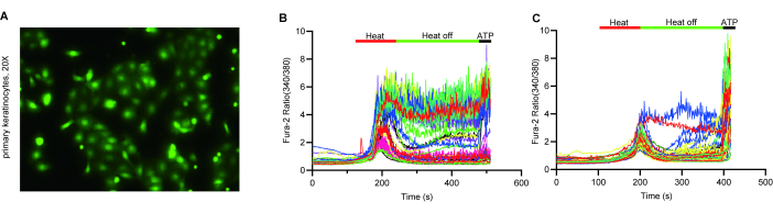 Fluorescence microscopy of mast cells; graphs show Fura-2 ratio data under heat and ATP conditions.