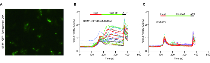 STIM1-GFP fluorescence microscopy, 20X, transient heat effects on Fura-2 ratio graphs, calcium signaling.