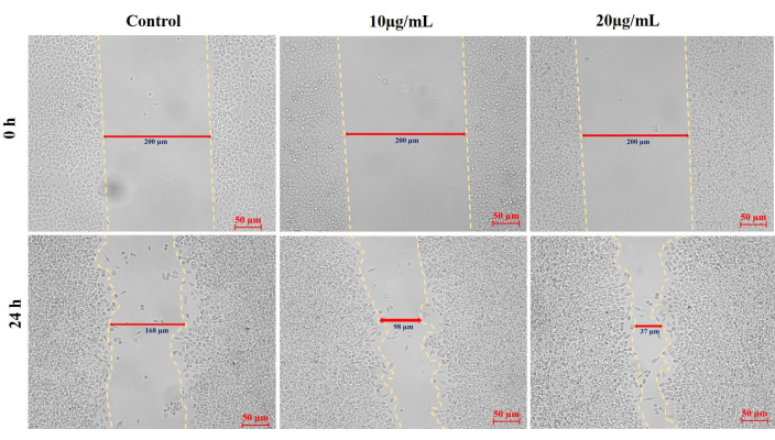 figure-results-6 Wound healing assay results; cell migration over 24h at varying concentrations, microscopy image.