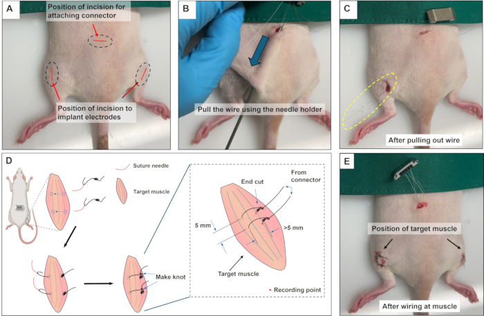 figure-results-4 Mouse electrode implantation process; surgical setup; electrode placement diagram for muscle recording.