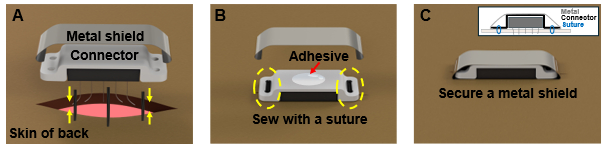 figure-results-5 Surgical implant process diagram; metal shield and connector attachment via adhesive and sutures.
