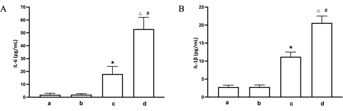 figure-results-6 IL-6 and IL-1β level comparison; bar chart; experimental results; inflammation markers analysis.