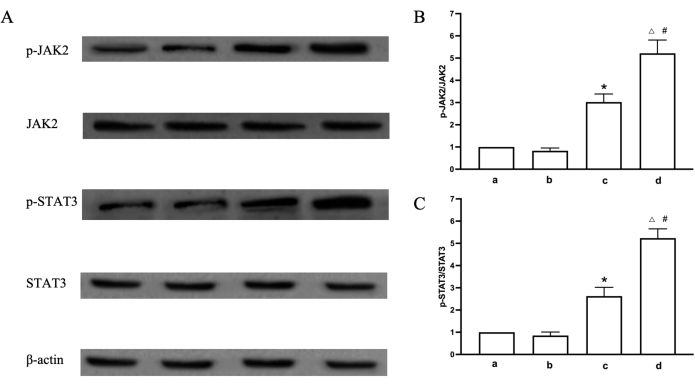 figure-results-7 Western blot analysis of p-JAK2, JAK2, p-STAT3, STAT3, and β-actin with graph results; protein expression.