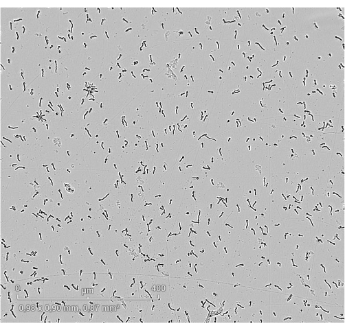 Bacterial cell diagram, microscope image, microbial population analysis, magnification scale visible.