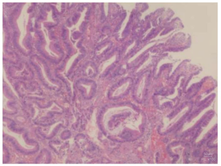 Histology slide, hematoxylin-eosin stain, tissue structure, microscopy, cellular analysis.
