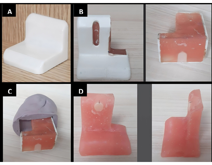 Dental prosthesis molding process, showing step-by-step resin casting techniques in different stages.