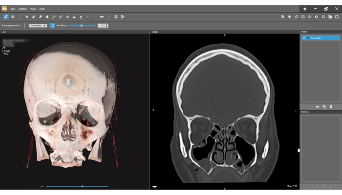CT skull scan and cross-sectional view in analysis software for medical imaging study.