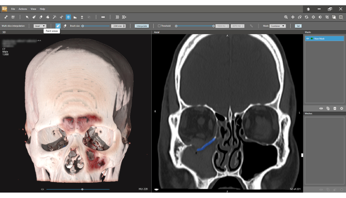 CT scan visualization; skull 3D reconstruction and axial view, anatomical analysis, medical imaging.