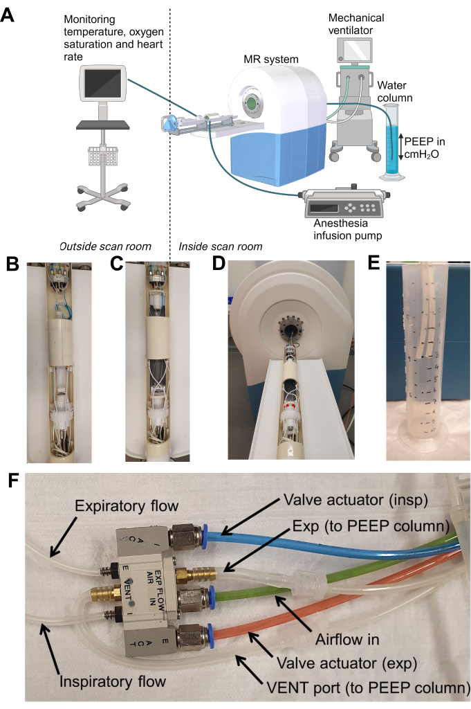 MR system setup diagram with ventilator, water column, and anesthesia pump indicating airflow paths.