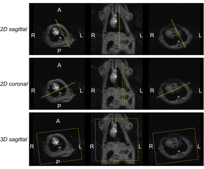 MRI anatomical views: 2D sagittal, coronal, and 3D sagittal diagrams; axial plane orientations.