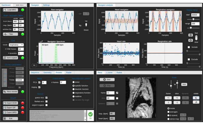 MRI analysis software interface; graph plots signal data, heart rate, respiration, reconstructed images.