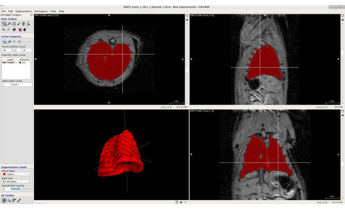 MRI segmentation analysis diagram; displays red-highlighted organ structure, axial and sagittal views.