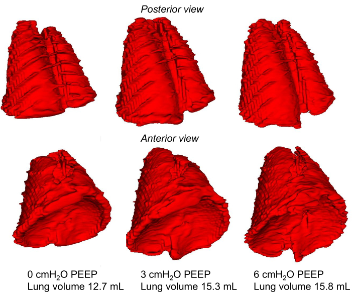 PEEP effect on lung volume, 3D model, anterior/posterior, respiratory mechanics, CT scan analysis.