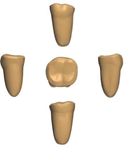Dental morphology diagram showing five views of a tooth, useful for anatomy studies.