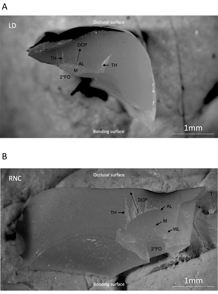 Cross-section of dental material interfaces; labeled diagram with bonding and occlusal surfaces.