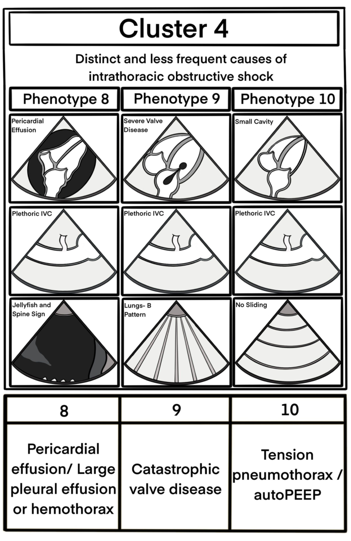 Cluster 4 diagram; intrathoracic obstructive shock phenotypes 8-10; cardiac ultrasound signs.