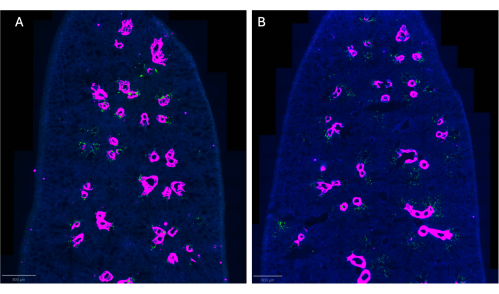 Fluorescence microscopy image comparing cellular structures with pink fluorescence in lung tissue.