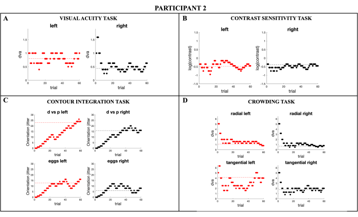 Participant 2 visual tasks; visual acuity, contrast sensitivity, contour integration, crowding graphs.