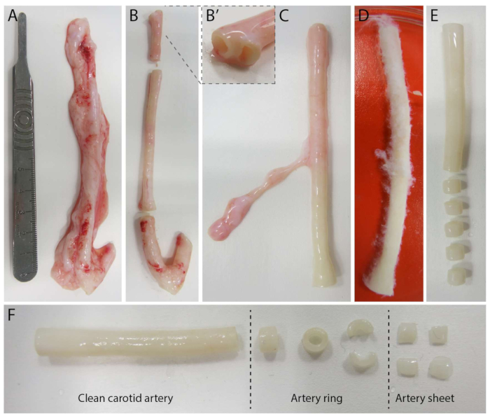 Carotid artery dissection and preparation diagram; tissue processing stages for histology analysis.