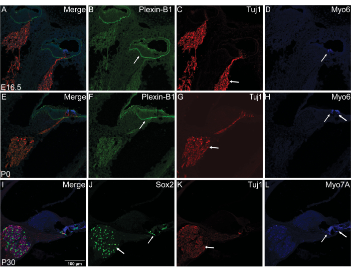 figure-results-1 Fluorescence microscopy of neural tissue, expression of Plexin-B1, Sox2, Tuj1, Myo6, Myo7A.