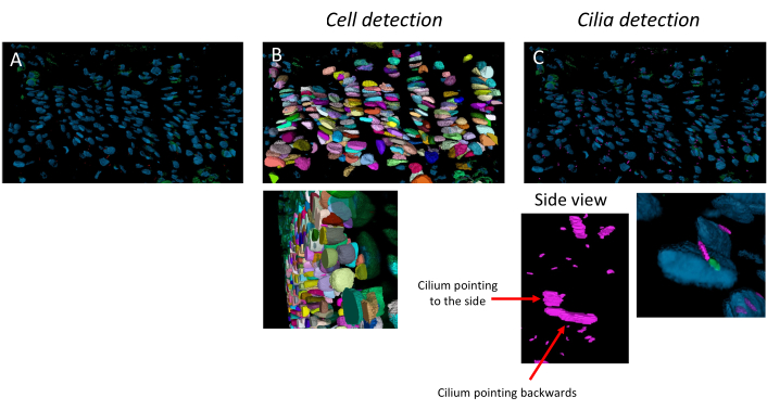 Cell and cilia detection diagram; microscopy results of cell segmentation and cilia orientation analysis.