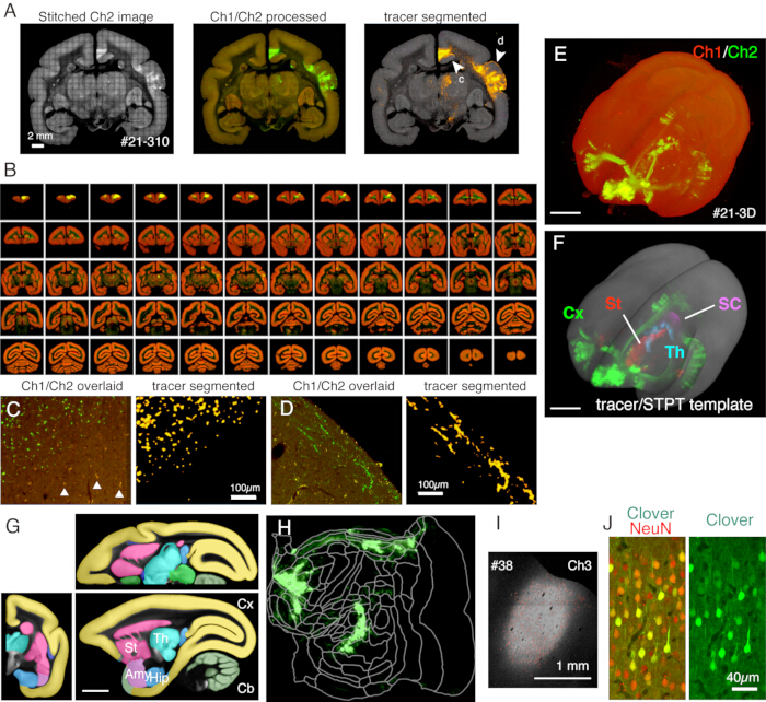 figure-results-5 Brain imaging analysis; tracer segmented; multiple views; brain anatomy diagrams; microscopy results.