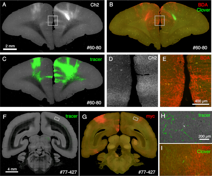 figure-results-6 Brain section imaging, tracer and BDA labeling, fluorescence microscopy results, neural pathway analysis.