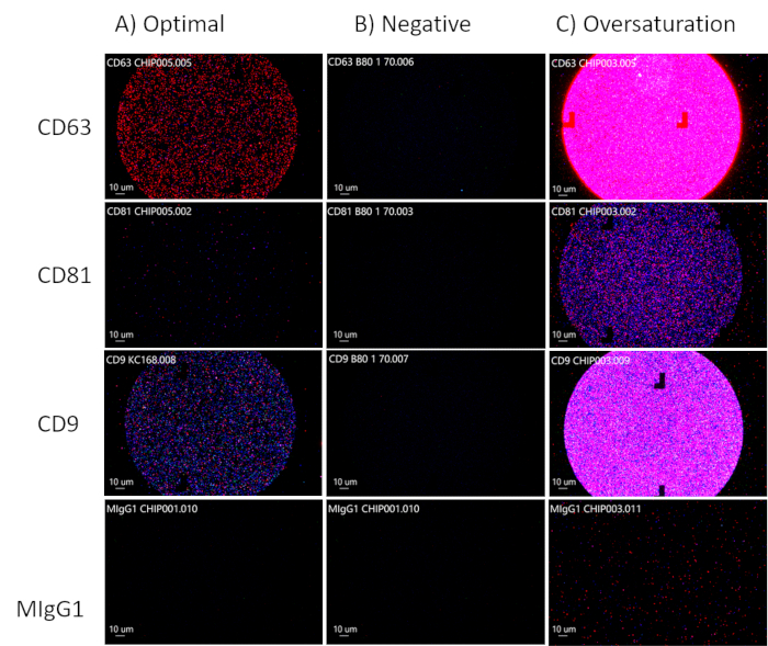 Optimal, negative, oversaturation microscopy images; CD63, CD81, CD9 markers; fluorescence assay.