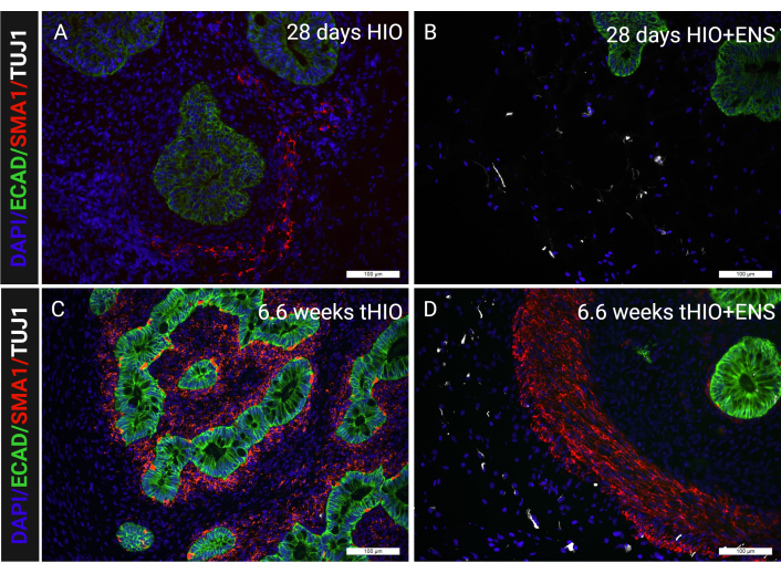 figure-results-6 免疫荧光显微镜,人肠类器官,肠神经系统整合,DAPI,ECAD,SMA1,TUJ1