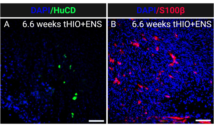 figure-results-7 HuCD 和 S100β 的免疫荧光显微镜图像,6.6 周时的神经分化,DAPI 染色。