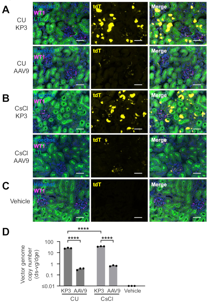 figure-results-4 Immunofluorescence microscopy of tdT and WT1 in kidney tissue; vector genome analysis bar graph.