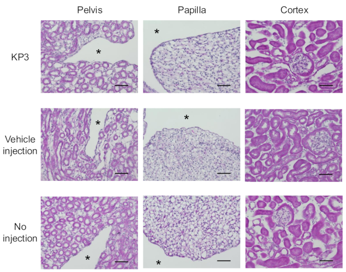 figure-results-6 Kidney tissue histology: pelvis, papilla, cortex, comparisons of KP3, vehicle, and no injection methods.