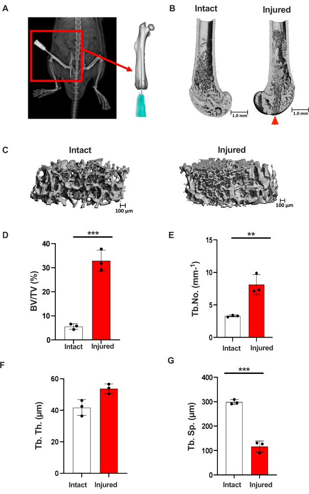 Bone injury analysis: 3D micro-CT scans, density comparisons, statistical chart data, trabecular metrics.