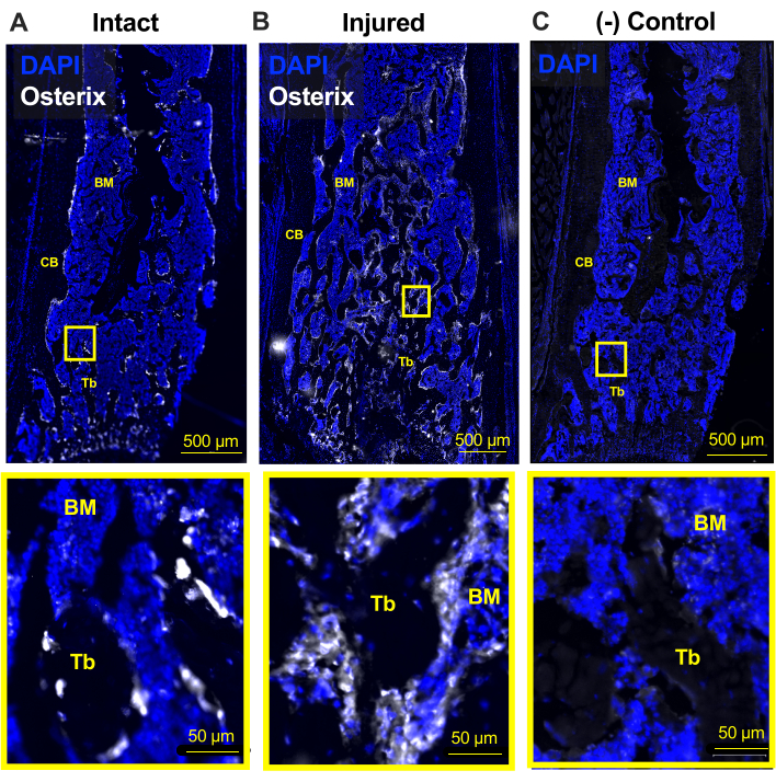DAPI Osterix staining; bone tissue microscopy comparing intact, injured, control samples.