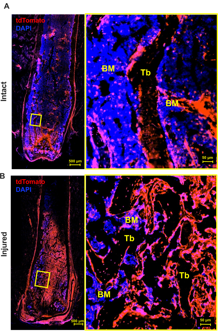 Bone marrow histology, tdTomato/DAPI stained, intact and injured samples, microscopy analysis.