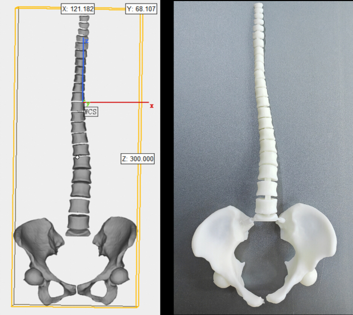 figure-results-7 3D spinal model comparison; digital diagram and physical replica for anatomical analysis.