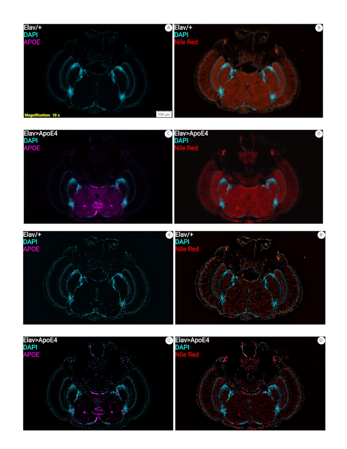 Brain fluorescence microscopy, DAPI, APOE, Nile Red staining comparison; histological analysis results.