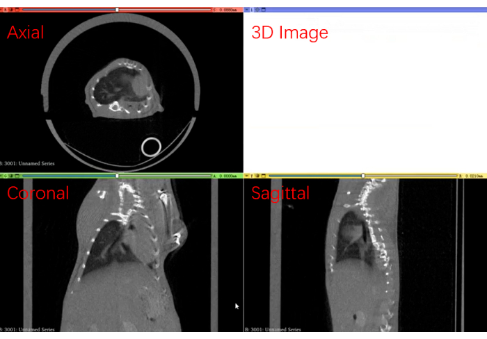 figure-protocol-2 CT scan axial, coronal, sagittal slices; imaging method comparison in medical diagnostic study.